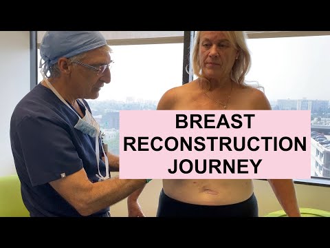 REAL PATIENTS REAL STORIES: Breast Reconstruction Journey & the Importance of Breast Preservation