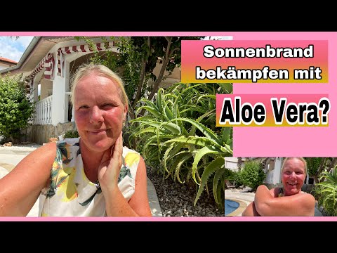 Oh nein, Sonnenbrand | Kann ich ihn mit der Aloe Vera abmildern? Experimente aus der Natur