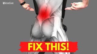 How to Fix Your Lower Back Pain for Good