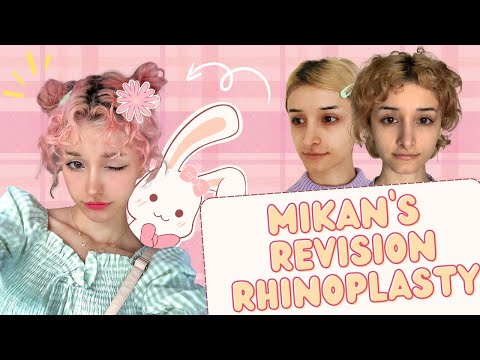 My nose was botched in the last nose job😭 | MIKAN's revision rhinoplasty surgery journey at BRAUN!😻