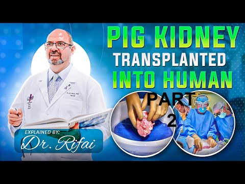 Xenotransplantation. Pig's Kidney Transplanted into a Human | PART 2 | The Virtual Nephrologist