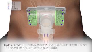 Hydro-Trach T 为气管切开患者所使用