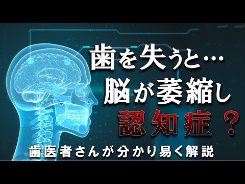 【 注意喚起 】歯を失うと…脳が萎縮し認知症…⁉　＃認知症　＃インプラント