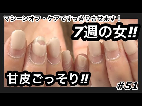 【#51】7週の女‼️ズタボロでご来店‼ゴッリゴリの甘皮️バチバチ綺麗にします‼️