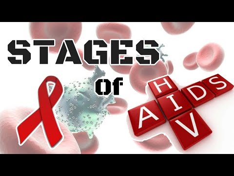 7 SIGNS & SYMPTOMS OF THE EARLY STAGES OF HIV.