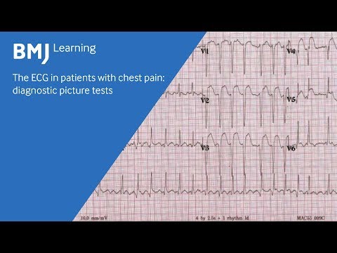 The ECG in patients with chest pain: diagnostic picture tests (1 of 2)