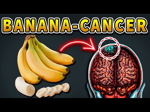 Never Eat Banana with "This"🍌🍌 Cause Cancer and Dementia! 3 Best Solutions! Healthy lifestyle