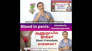 Blood In Penis | Blood in semen | ஆணுறுப்பில் இரத்தம் Short Frenulum காரணமா ? Dr A S Karthikeyan