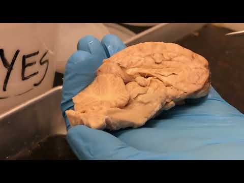 Mid sagital View of Sheep Brain (Anatomy & Physiology I ￼– BIO)