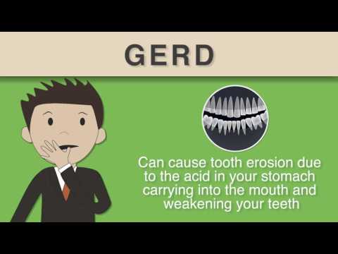 Did You Know - GERD Can Cause Bad Breath