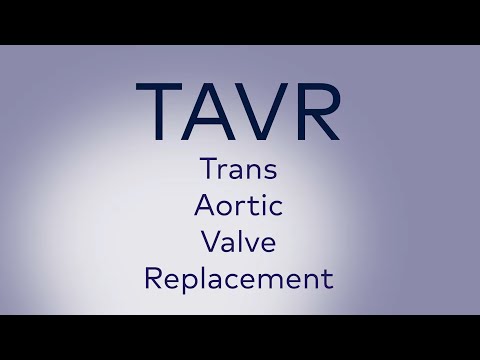 Transcatheter Aortic Valve Replacement (TAVR) at LewisGale Medical Center