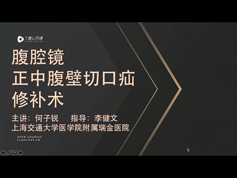 丁香公开课|普外必备：腹腔镜腹外疝教程| 1 腹腔镜正中切口疝