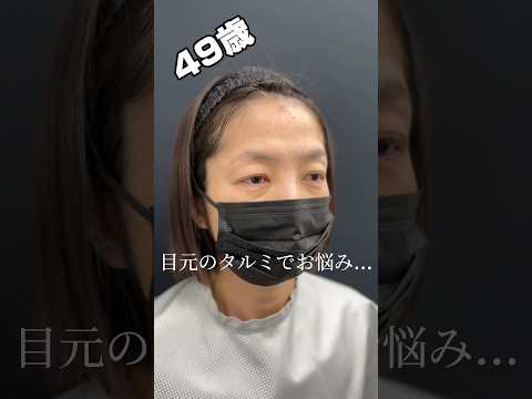 アラフィフ女性 目元切開で10歳若返り☆ #眉下切開 #40代メイク ＃50代