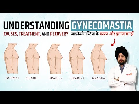 Gynecomastia Causes, Symptoms, Exercises, Surgery or Treatment, Cost & Recovery | Man Boobs Problem