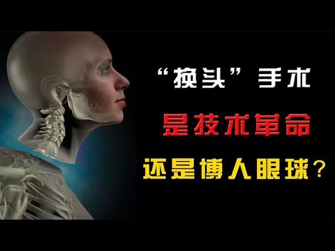 世界首例换头手术：是技术革新还是博人眼球？进展到什么程度了？