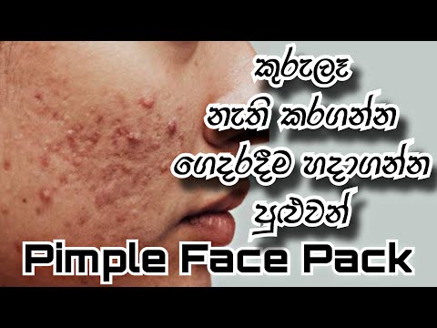 NEEM FACE PACK FOR PIMPLES | SINHALA BEAUTY TIPS 2023