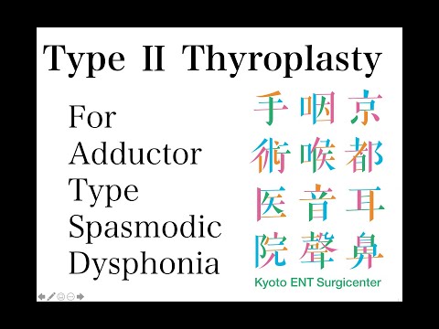 Type 2 thyroplasty for Adductor Type Spasmodic Dysphonia. 57YM.