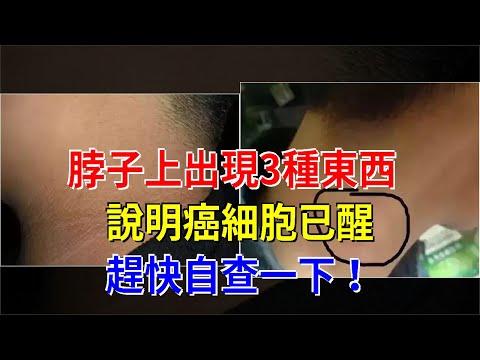 脖子上出現3種東西，說明癌細胞已醒，趕快自查一下！，[健康之家]