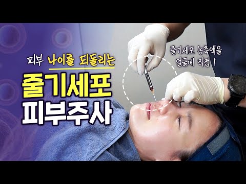 줄기세포 피부주사 CD34+ 피부의 나이를 근본적으로 되돌리는 안티에이징 주사ㅣ모즈의원- 모즈클리닉