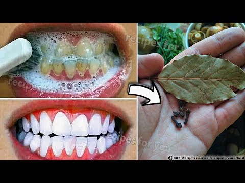 Secret that Dentists don't want you to know: Remove Tartar and Teeth Whitening in just 2 minutes