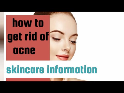 how to get rid of acne #acnescars #acnecream #acnejourney#acne#bacne!skincare information