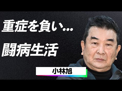 【衝撃】小林旭、転落し現在瀕死の重傷がヤバい...拒否し続けた治療と募金活動に駆けつけた理由に驚愕…！