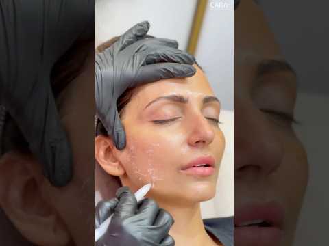 Hifu Treatment for Non-Surgical Facelift | High Intensity Focused Ultrasound Treatment