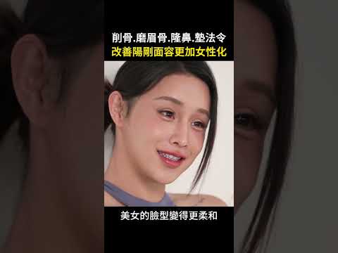 臉部柔化手術跨性別削骨柔化臉部線條 台北教主 Dr.郭菁松醫師