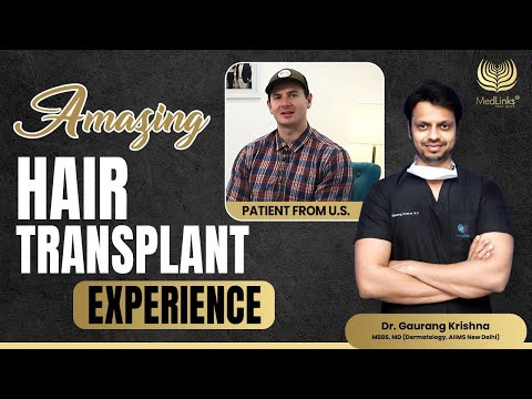 Amazing Hair Transplant Experience in Delhi 2024 | Cost of Hair transplant in Delhi 2024 | MedLinks