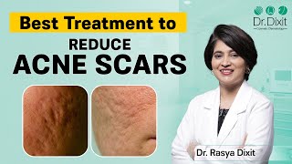 Acne Scars Treatment By Dermatologist | Best Skin Specialist In Bangalore | Dr. Rasya Dixit