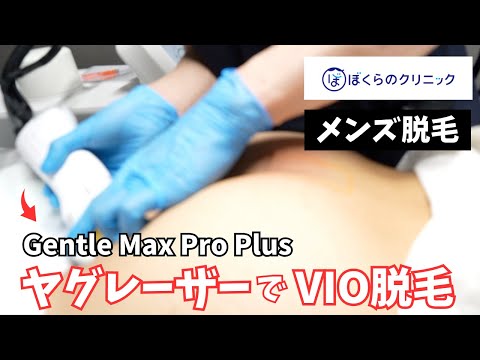 【メンズ脱毛】最強ヤグレーザーGentle Max Pro PlusでVIO脱毛した結果がヤバかった・・・【都度払い】