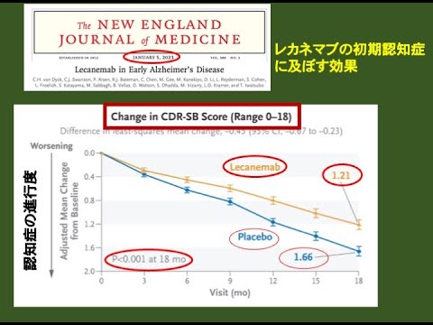 ドクター徳のいきいき健康チャンネル『新しい認知症薬（レカネマブ）を検証する』