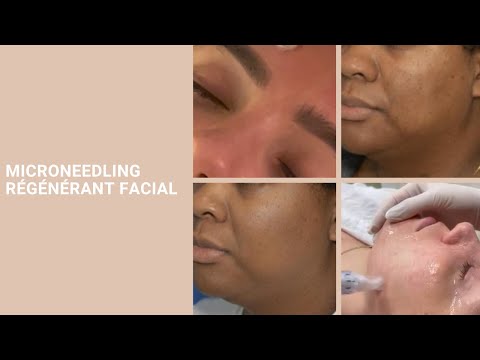 Microneedling Régénérant Facial