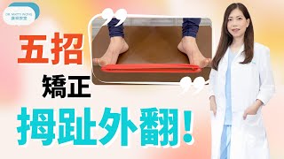 五招矯正拇趾外翻 -脊醫王鳳恩(中/Eng Sub) - Five Exercises to Improve Bunions - Dr Matty Wong Chiropractor