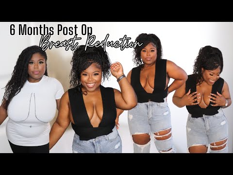 😍 6 MONTHS POST OP| BREAST REDUCTION | THE NEW GIRLSSS LOOK SO GOOD!!