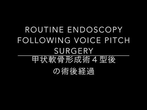 甲状軟骨形成術４型術後の声の変化　Routine Endoscopy Following Voice Pitch Surgery