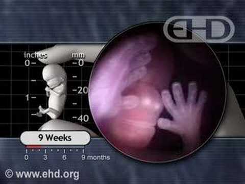 Fetal Development -- The Eyelids Close