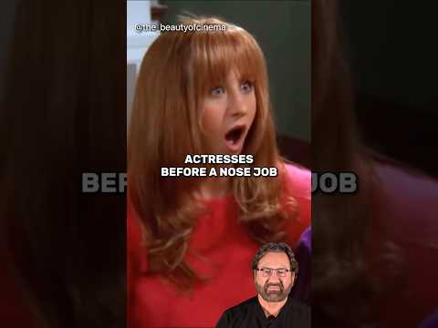 Actresses Before a Nose Job - Surgeon Reacts