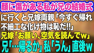 【スカッとする話】兄の結婚式に行くと顔に傷がある私に兄嫁両親「不細工な化け物は恥！帰れ！」兄嫁「空気を読んでｗ」→兄「…帰るか」私「うん」直後、衝撃のサプライズがｗ