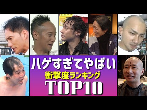 【頭皮丸見え】ハゲがすぎてやばい！衝撃度ランキングTOP10