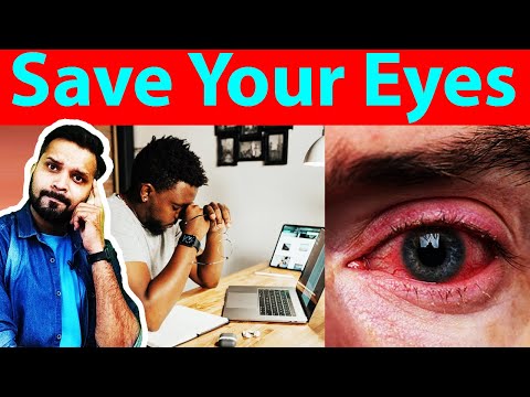 Save Your Eyes from Screen Time Strain 👁️💻 | Essential Tips for Healthy Vision