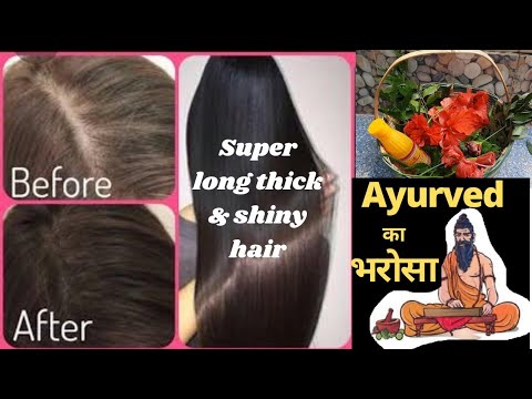 हफ्ते मे 1बार काले,घने, लमबे बाल. Dandruff पुरी तरहा से खतम, बालों मे भरपूर चमक ,दो मुह से मुक्ति.