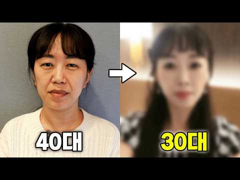 ✔40대 동안성형 브이로그 | 출혈로 수술 중단..?💥 | 상안검, 리프팅, 지방이식 브이로그 [하민2Vlog]