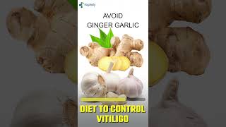 क्या Diet Vitiligo को Control कर सकती है? | Kayakalp Global #shorts #shortsfeed