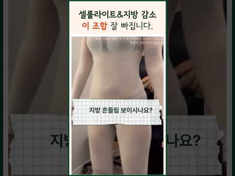 지방흡입후 바이오본드 지방감소 셀룰라이트 이 조합 추펀드려요 | 다이어트 여름준비 LPG #modsclinic #모즈클리닉