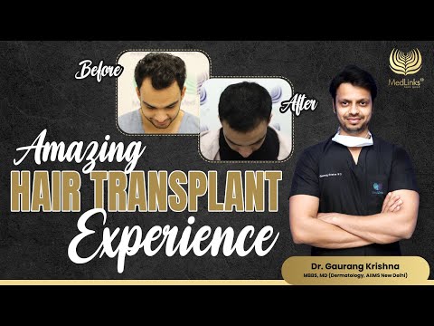 Amazing Hair Transplant Experience Ft. @kashishanand.9  | Best Hair transplant in Delhi  | MedLinks