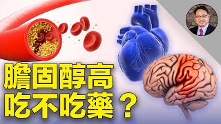 膽固醇到什麼指標，才需要吃藥？注意！他汀類藥物有這種副作用。