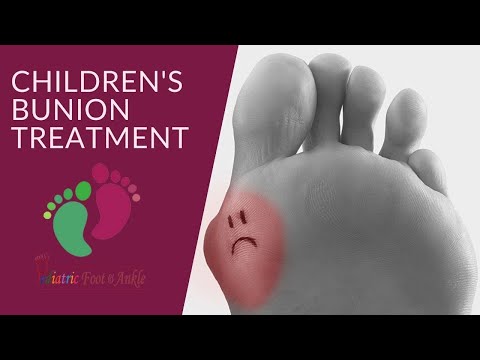 Bunion Treatment for Children