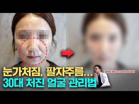 출산 후 급격하게 늙어버린 얼굴!! 자연스럽게 처진 얼굴 올리기 (Feat. 울쎄라&필러)