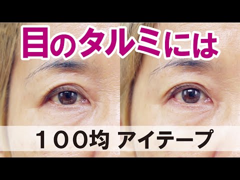 【目の弛みにはアイテープ♪】58歳！三画目や三重が加速する